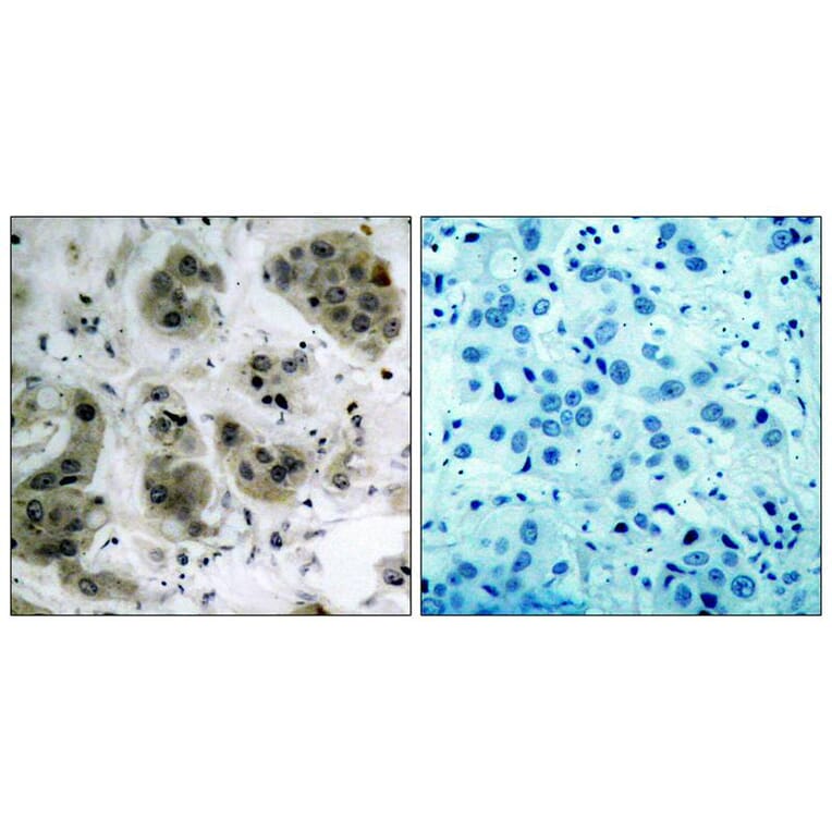Immunohistochemistry - Akt (Ab-473) Antibody from Signalway Antibody (21054) - Antibodies.com