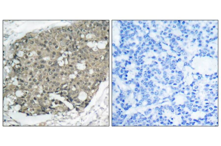 Immunohistochemistry - Akt (Ab-308) Antibody from Signalway Antibody (21055) - Antibodies.com