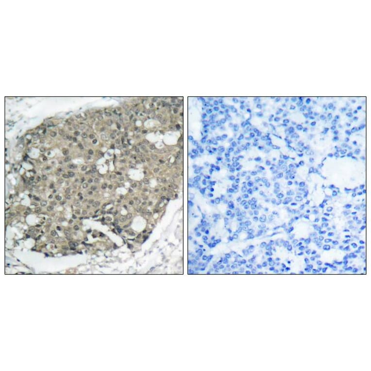 Immunohistochemistry - Akt (Ab-308) Antibody from Signalway Antibody (21055) - Antibodies.com