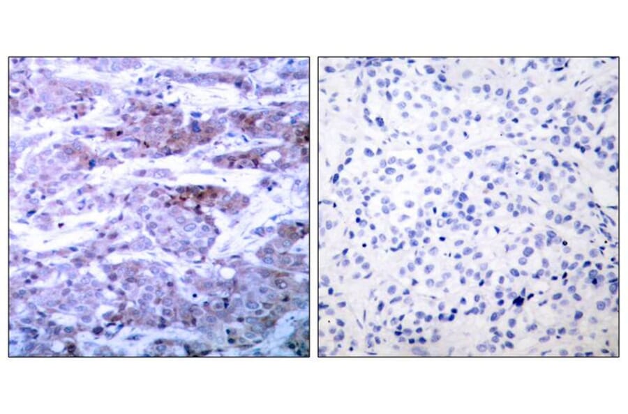 Immunohistochemistry - BAD (Ab-112) Antibody from Signalway Antibody (21062) - Antibodies.com