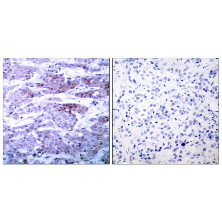 Immunohistochemistry - BAD (Ab-112) Antibody from Signalway Antibody (21062) - Antibodies.com