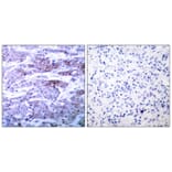 Immunohistochemistry - BAD (Ab-112) Antibody from Signalway Antibody (21062) - Antibodies.com
