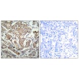 Immunohistochemistry - BAD (Ab-155) Antibody from Signalway Antibody (21064) - Antibodies.com