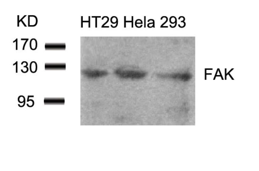 Western blot - FAK (Ab-861) Antibody from Signalway Antibody (21076) - Antibodies.com