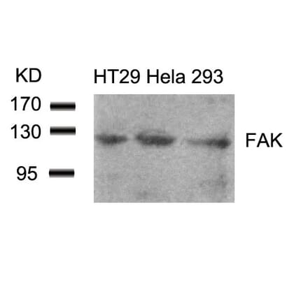 Western blot - FAK (Ab-861) Antibody from Signalway Antibody (21076) - Antibodies.com