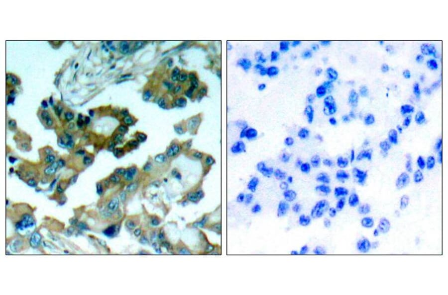 Immunohistochemistry - FAK (Ab-861) Antibody from Signalway Antibody (21076) - Antibodies.com