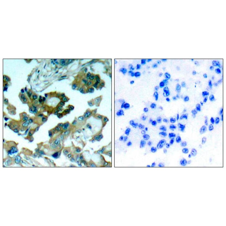 Immunohistochemistry - FAK (Ab-861) Antibody from Signalway Antibody (21076) - Antibodies.com