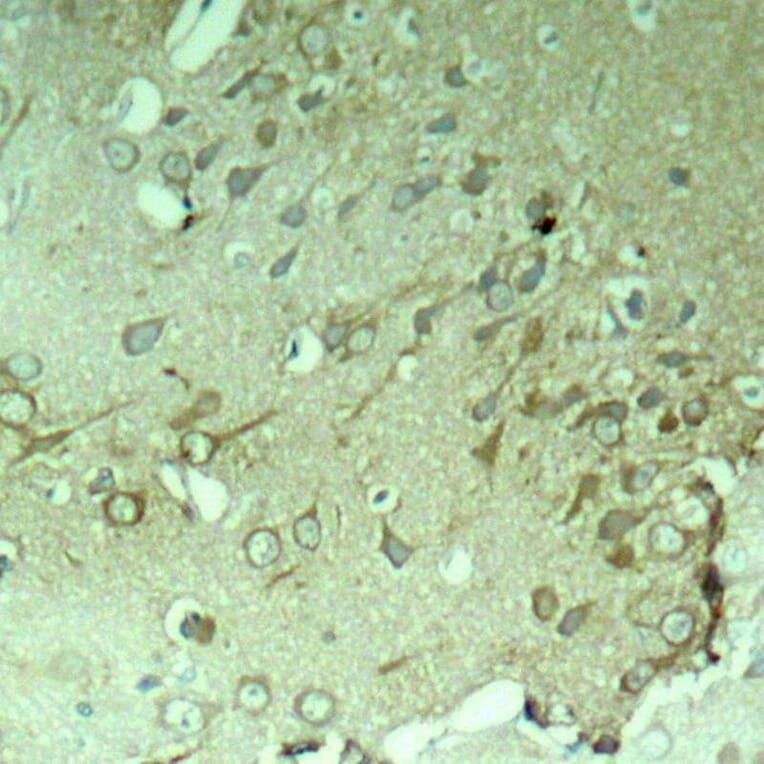 Immunohistochemistry - Tau (Ab-396) Antibody from Signalway Antibody (21093) - Antibodies.com