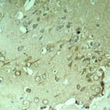 Immunohistochemistry - Tau (Ab-396) Antibody from Signalway Antibody (21093) - Antibodies.com
