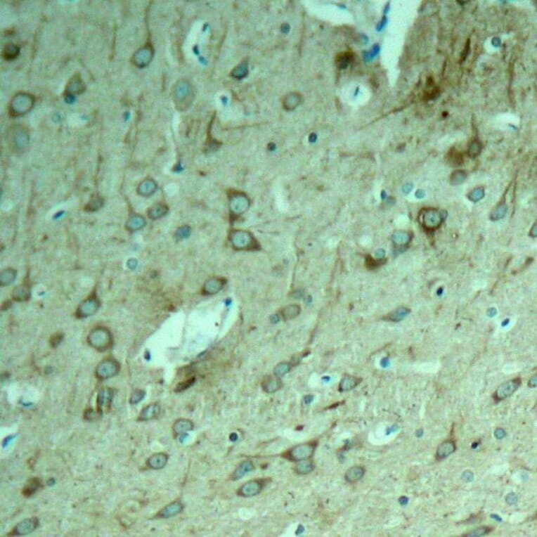 Immunohistochemistry - Tau (Ab-231) Antibody from Signalway Antibody (21099) - Antibodies.com