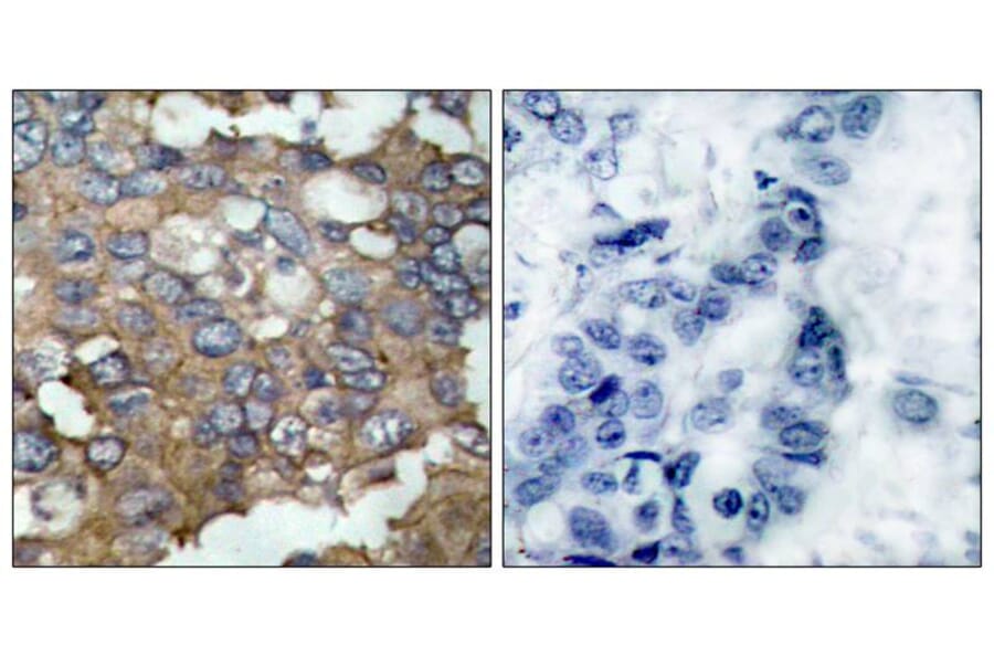 Immunohistochemistry - Src (Ab-529) Antibody from Signalway Antibody (21168) - Antibodies.com