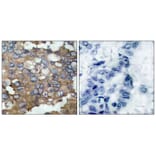 Immunohistochemistry - Src (Ab-529) Antibody from Signalway Antibody (21168) - Antibodies.com