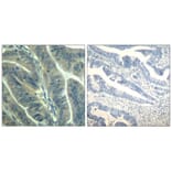 Immunohistochemistry - CDK6 (Ab-24) Antibody from Signalway Antibody (21543) - Antibodies.com