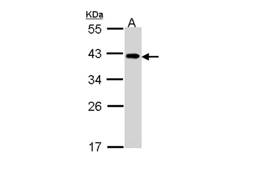 eIF2B beta antibody from Signalway Antibody (22394) - Antibodies.com