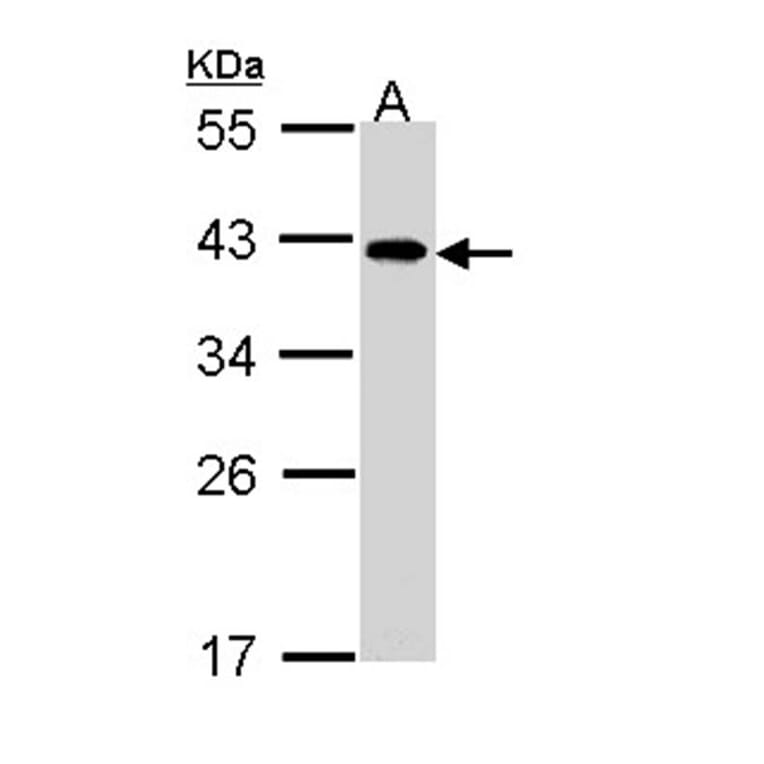 eIF2B beta antibody from Signalway Antibody (22394) - Antibodies.com