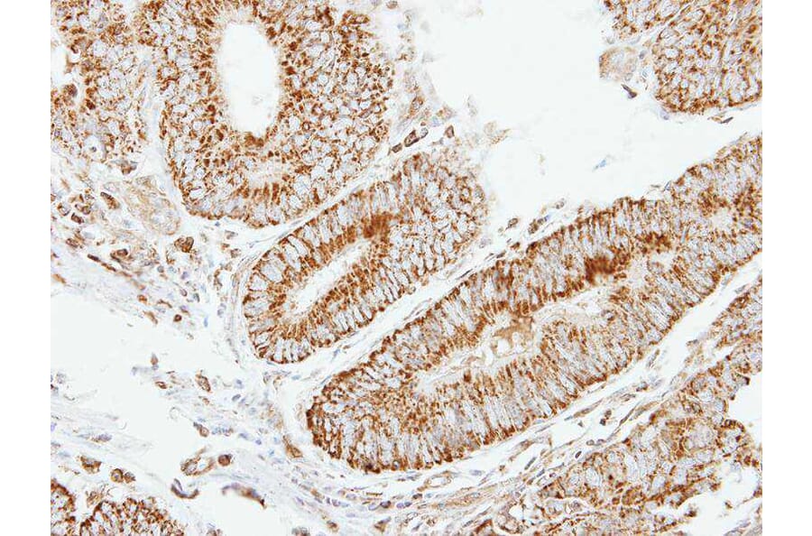 Immunohistochemistry - eIF2B beta antibody from Signalway Antibody (22394) - Antibodies.com