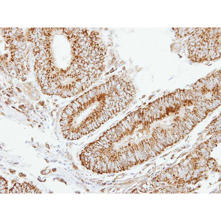 Immunohistochemistry - eIF2B beta antibody from Signalway Antibody (22394) - Antibodies.com
