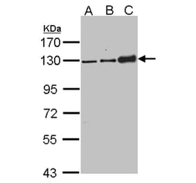 Desmoglein-2 antibody from Signalway Antibody (22656) - Antibodies.com