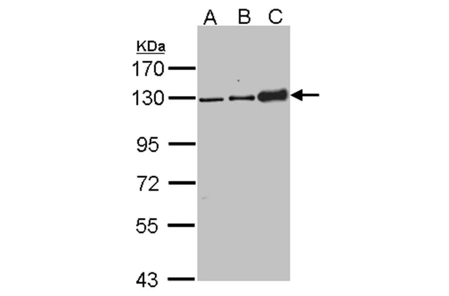 Desmoglein-2 antibody from Signalway Antibody (22656) - Antibodies.com