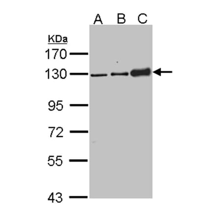 Desmoglein-2 antibody from Signalway Antibody (22656) - Antibodies.com
