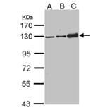 Desmoglein-2 antibody from Signalway Antibody (22656) - Antibodies.com