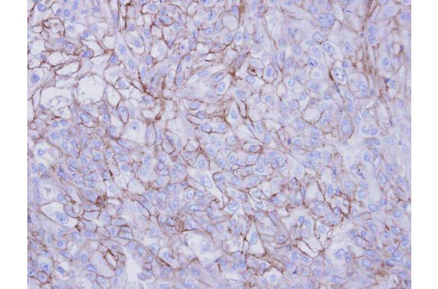 Immunohistochemistry - Desmoglein-2 antibody from Signalway Antibody (22656) - Antibodies.com