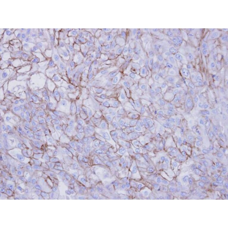 Immunohistochemistry - Desmoglein-2 antibody from Signalway Antibody (22656) - Antibodies.com