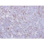 Immunohistochemistry - Desmoglein-2 antibody from Signalway Antibody (22656) - Antibodies.com