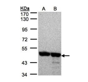 Annexin VII antibody from Signalway Antibody (22913) - Antibodies.com
