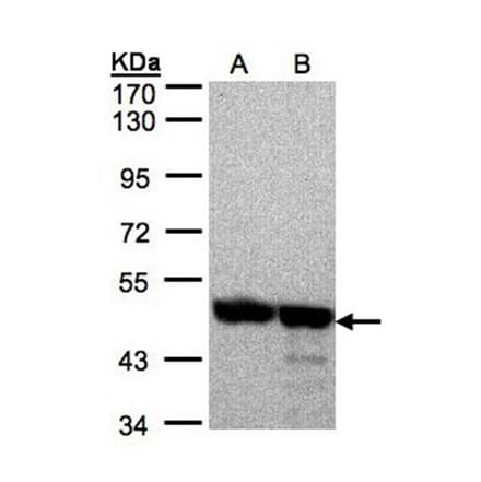 Annexin VII antibody from Signalway Antibody (22913) - Antibodies.com