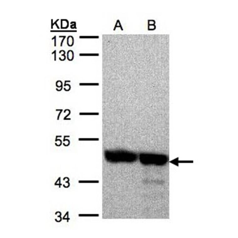Annexin VII antibody from Signalway Antibody (22913) - Antibodies.com
