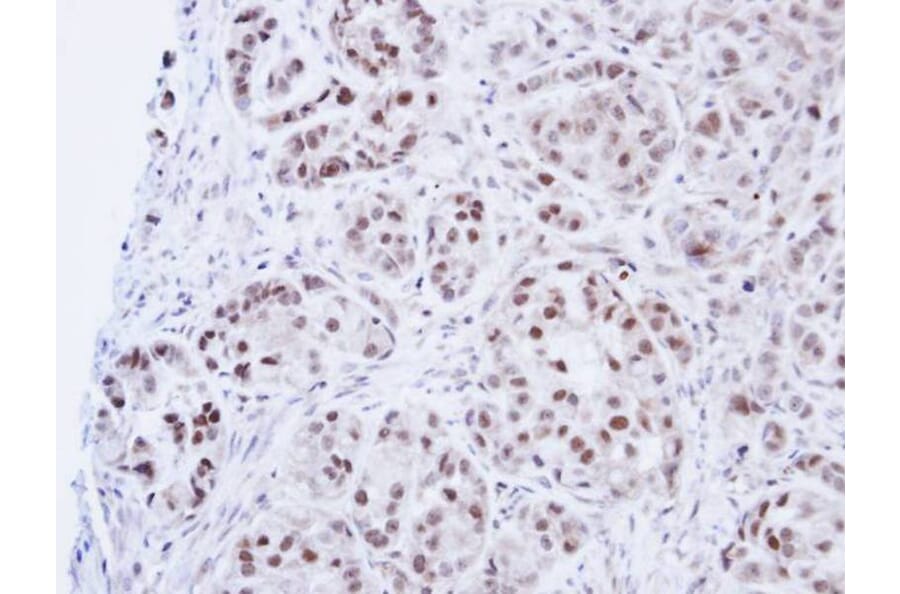 Immunohistochemistry - DNA ligase 3 antibody from Signalway Antibody (22940) - Antibodies.com
