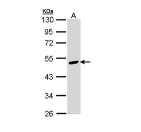 Angiotensin antibody from Signalway Antibody (22960) - Antibodies.com