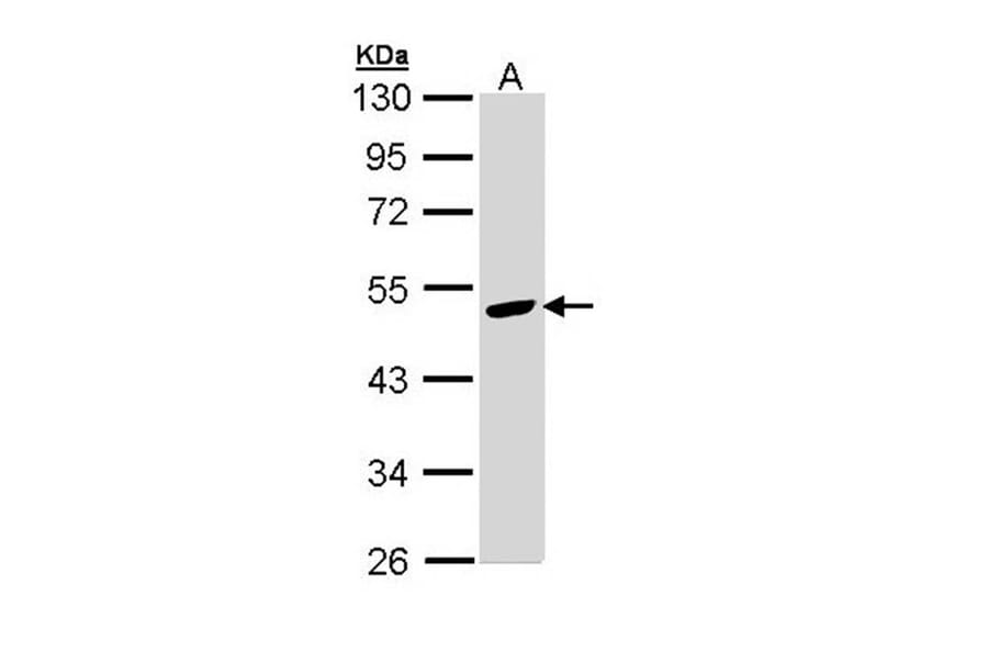Angiotensin antibody from Signalway Antibody (22960) - Antibodies.com