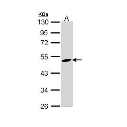 Angiotensin antibody from Signalway Antibody (22960) - Antibodies.com