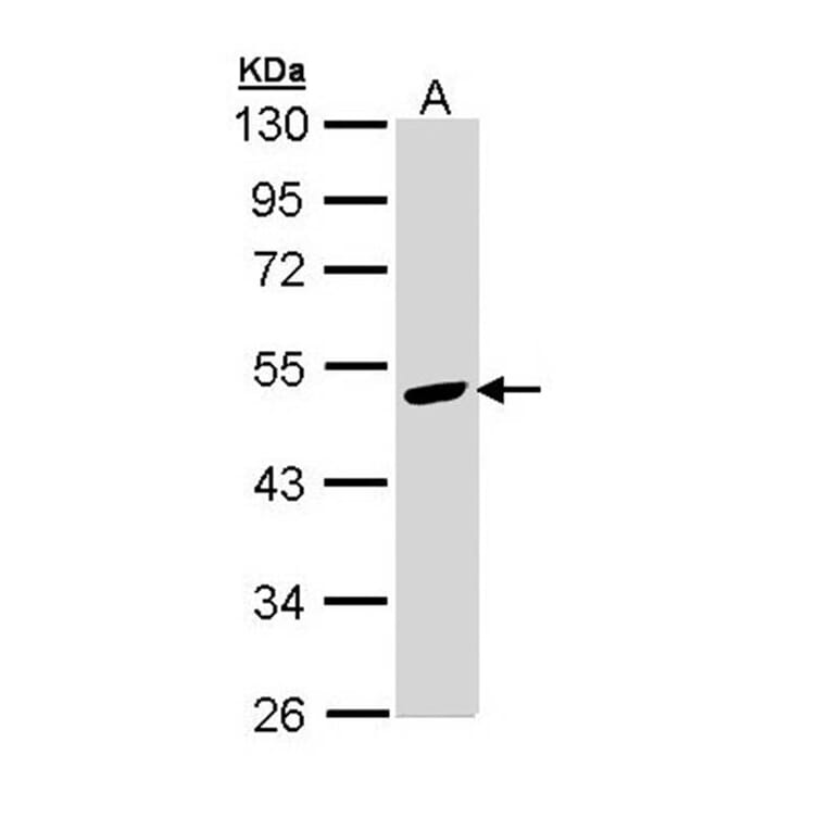 Angiotensin antibody from Signalway Antibody (22960) - Antibodies.com