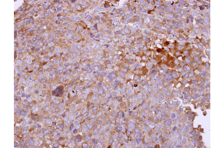 Immunohistochemistry - Angiotensin antibody from Signalway Antibody (22960) - Antibodies.com