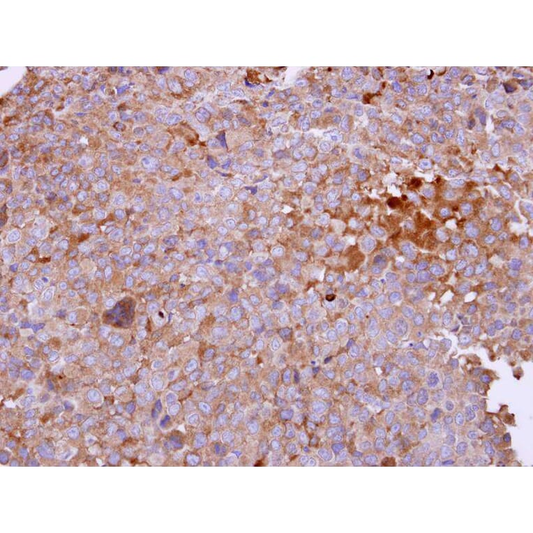 Immunohistochemistry - Angiotensin antibody from Signalway Antibody (22960) - Antibodies.com