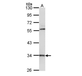 cathepsin D antibody from Signalway Antibody (22988) - Antibodies.com