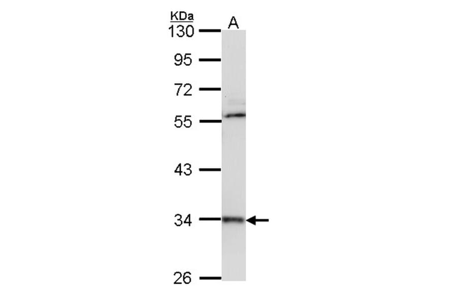 cathepsin D antibody from Signalway Antibody (22988) - Antibodies.com