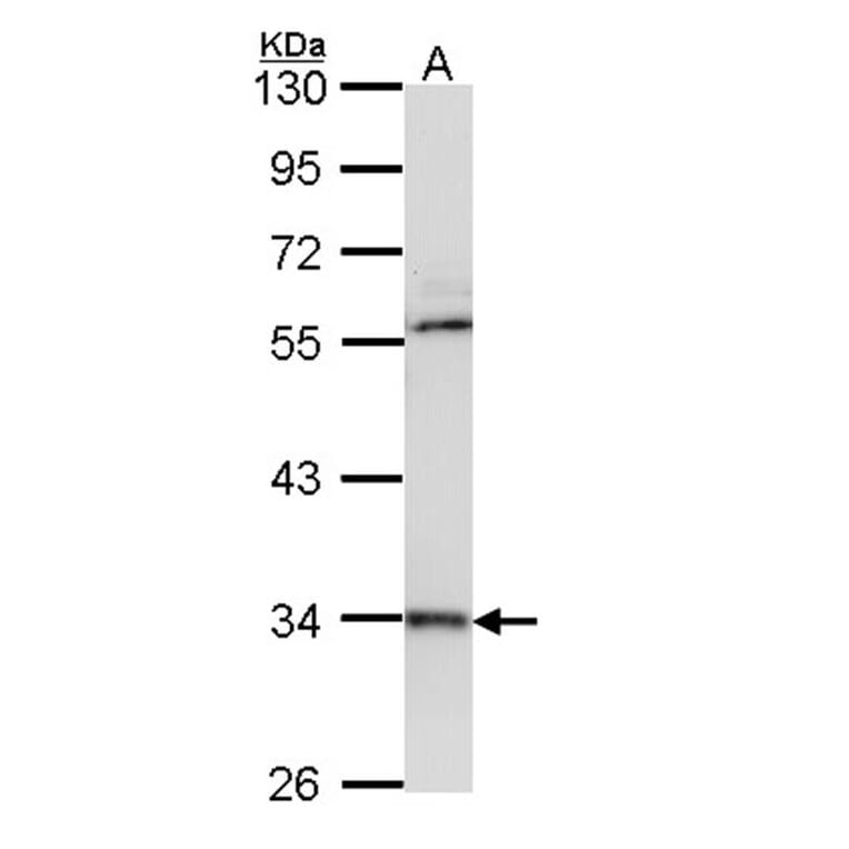 cathepsin D antibody from Signalway Antibody (22988) - Antibodies.com