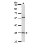 cathepsin D antibody from Signalway Antibody (22988) - Antibodies.com