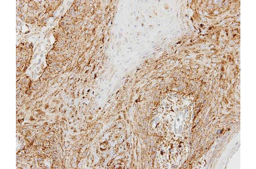 Immunohistochemistry - cathepsin D antibody from Signalway Antibody (22988) - Antibodies.com