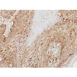 Immunohistochemistry - cathepsin D antibody from Signalway Antibody (22988) - Antibodies.com