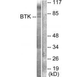 Western blot - BTK (Ab-222) Antibody from Signalway Antibody (33121) - Antibodies.com