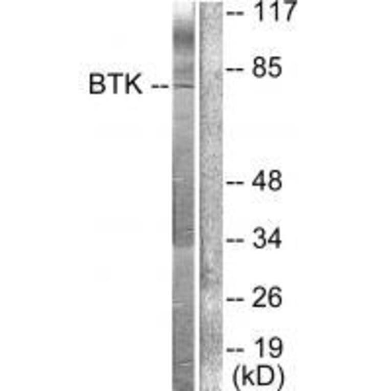 Western blot - BTK (Ab-222) Antibody from Signalway Antibody (33121) - Antibodies.com