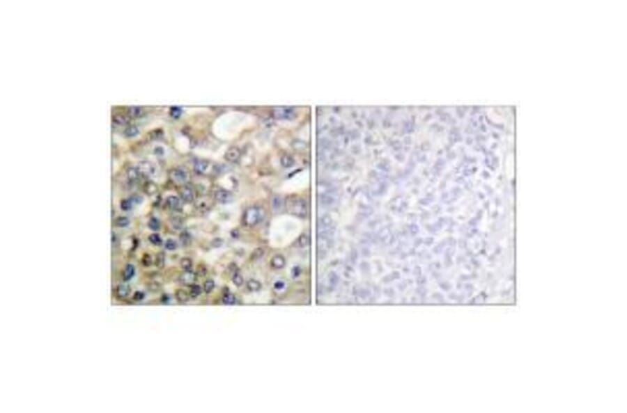 Immunohistochemistry - BTK (Ab-222) Antibody from Signalway Antibody (33121) - Antibodies.com