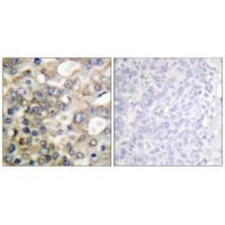 Immunohistochemistry - BTK (Ab-222) Antibody from Signalway Antibody (33121) - Antibodies.com