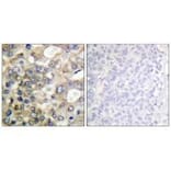 Immunohistochemistry - BTK (Ab-222) Antibody from Signalway Antibody (33121) - Antibodies.com
