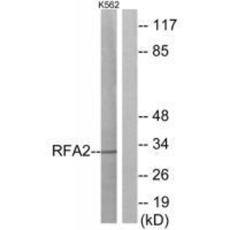Western blot - RFA2 (Ab-21) Antibody from Signalway Antibody (33162) - Antibodies.com